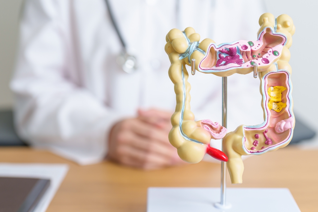 Appendicitis early symptoms