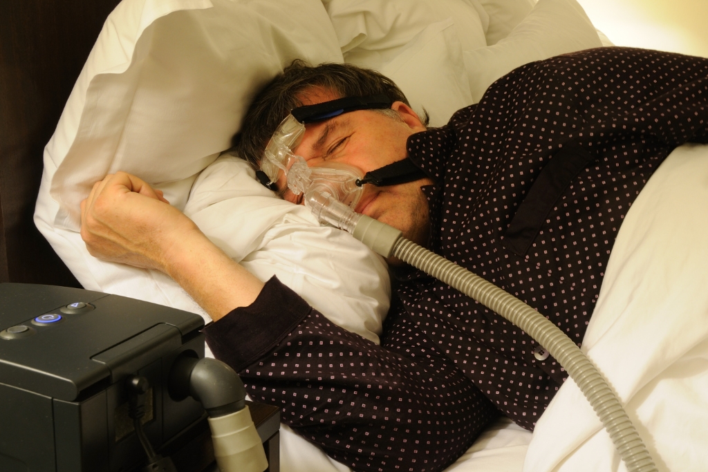 obstructive sleep apnoea